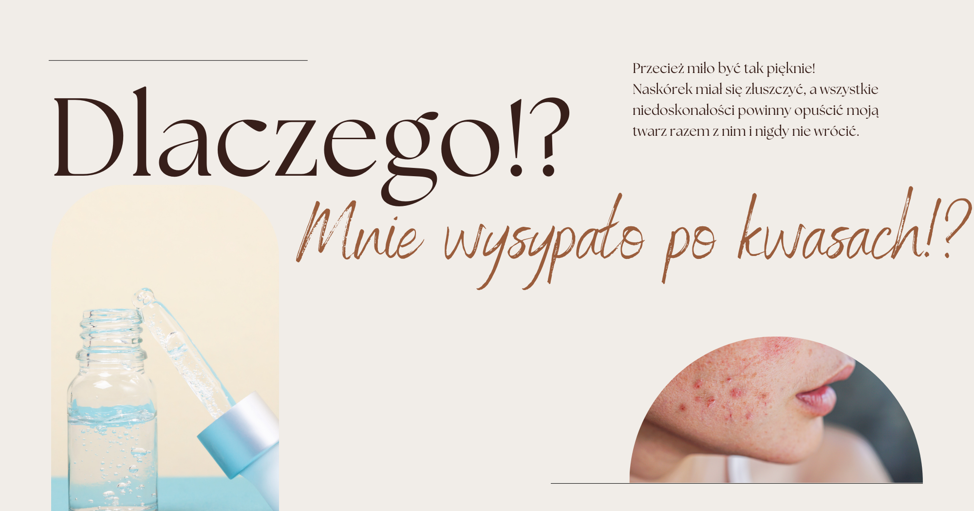 Dlaczego mnie wysypało po kwasach?